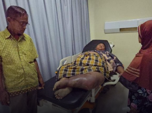 Pemuda obesitas dari Sragen